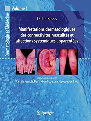 Dermatologie et médecine. Vol. 1. Manifestations dermatologiques des connectivites, vasculites et af