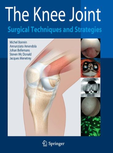 the knee joint: surgical techniques and strategies