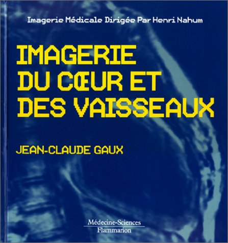 Imagerie du coeur et des vaisseaux